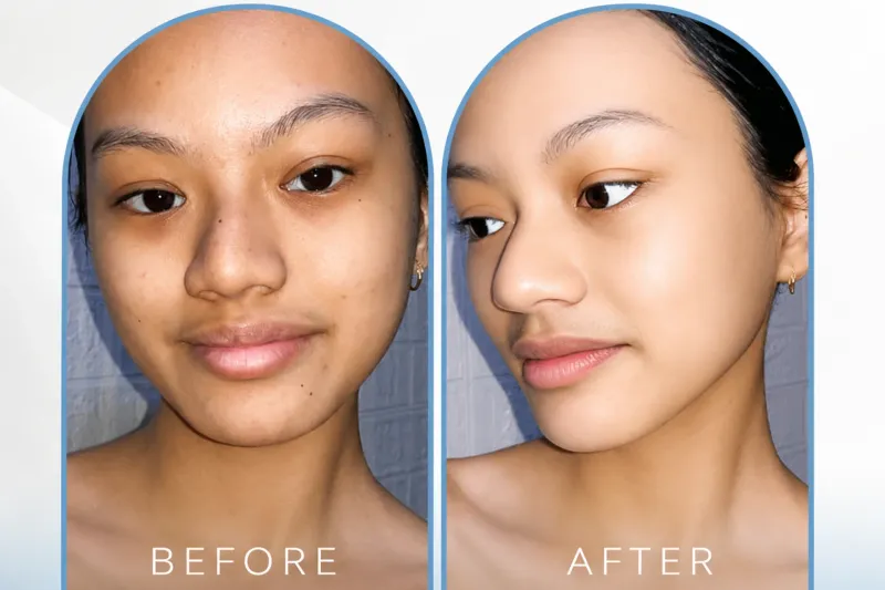 Facial + Sponge Peel Package